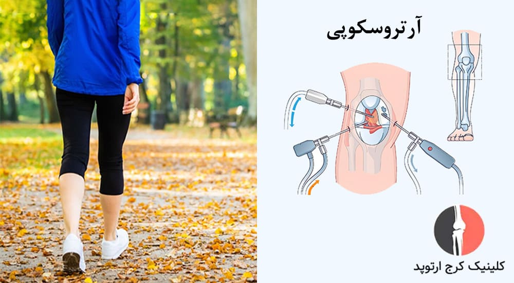 پیادهروی پس از جراحی مینیسک زانو