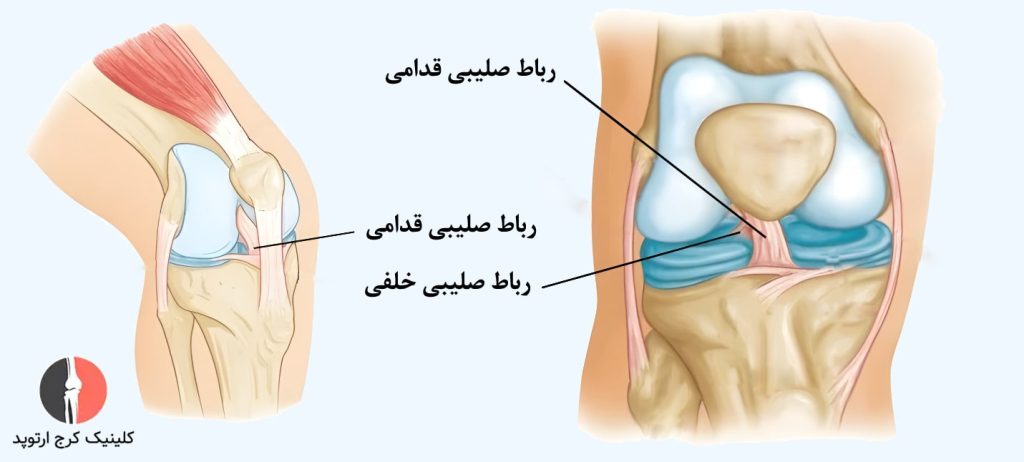 رباط صلیبی زانو
