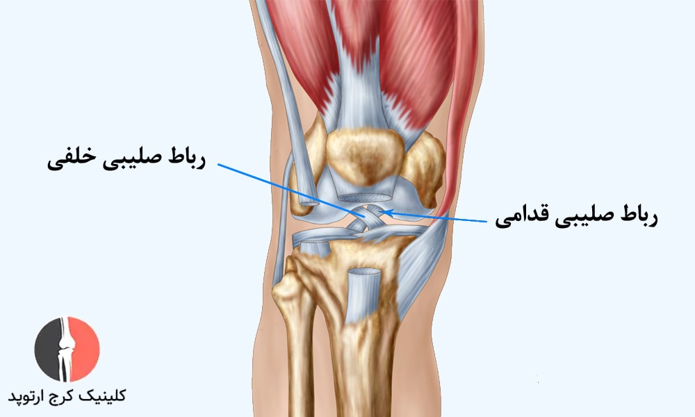 رباط صلیبی زانو