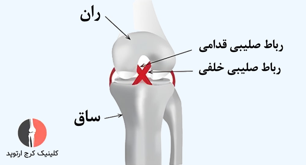 رباطهای صلیبی زانو بهصورت ضربدری شکل (X)