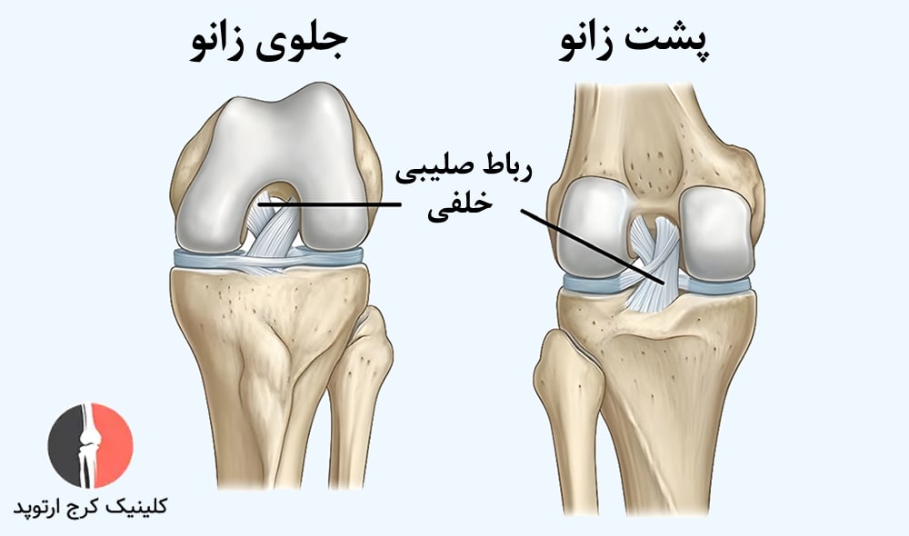 رباط صلیبی خلفی