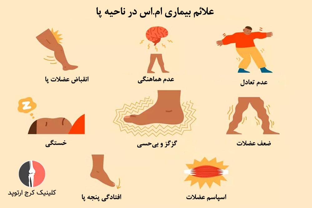 آسیب به اعصاب